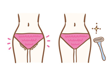 Illustration of pubic hair treatment