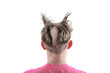 © soupstock - Teen with an odd bad haircut