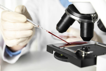  Scientist dripping blood sample onto slide on microscope in laboratory, closeup. Virus research