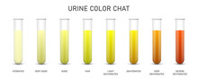 Creative Vector Illustration Of Urine Test Chat, Assessing Hydration, Dehydration, Test Tubes Isolated On Background. Art Design Pee Urine Color Diagram Template. Concept Medical Biomaterial Element