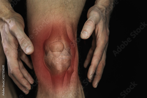 Fotomural knee pain. male leg with bone joint inflammation illustration