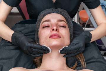 Wall Mural - wiping a pimple face in beauty parlor