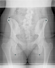 Distorted Skeleton Free Stock Photo - Public Domain Pictures