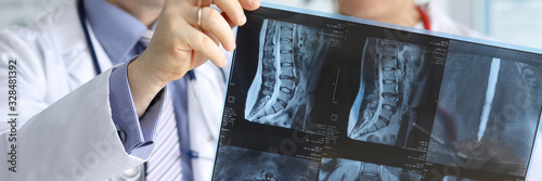 Fotomural Close-up of doctors hands holding x-ray vertebra in different projections
