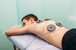 patient applying electrical stimulation therapy on his back