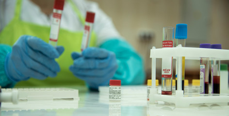 hand of a scientific taking a blood sample tube hand holding a tube test