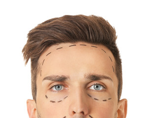 Wall Mural - Young man with marks on his face against white background, closeup. Concept of plastic surgery