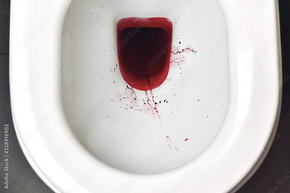 Blood in toilet bowl, Rectal bleeding from hemorrhage, Blood in urine ...