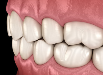 Wall Mural - Healthy human teeth with normal occlusion. Medically accurate tooth 3D illustration