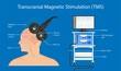 Transcranial magnetic stimulation TMS non invasive field obsessive compulsive disorder PTSD treat
