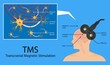 Transcranial magnetic stimulation TMS non invasive field obsessive compulsive disorder PTSD treat