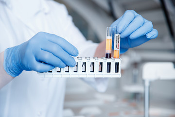 Wall Mural - bioengineer holds test tubes of blood samples for dna analysis and presence of virus in cytoplasm, b