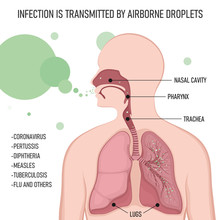 Infection Is Transmitted By Airborne Droplets. Human Body With Lungs Affected By Virus Cells Through The Respiratory Tract.