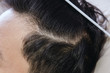 Close up of a hair dandruff , Black hair
