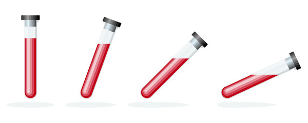 Canvas Print - blood test. blood samples in a glass test tubes.