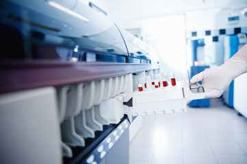 Wall Mural - scientist downloads blood samples to test dna, hiv, aids, virus on laboratory