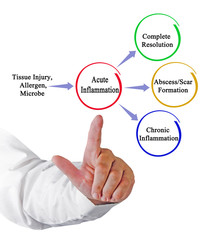 Poster - Three ways of resolution of acute inflamation