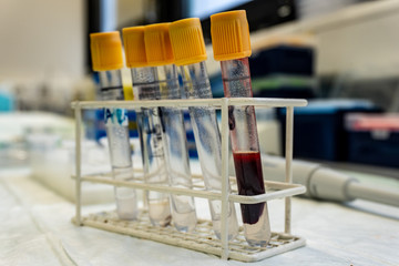 Blood sample in Vacutainer