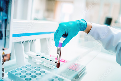 Cuadros en Lienzo Medical scientist testing blood sample for coronavirus, covid19 pandemic