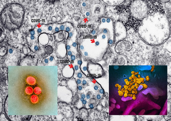 Wall Mural - Coronavirus microscope photo