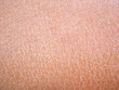 dry skin or ichthyosis texture detail in asian women using for moisturizer lotion, cream or beauty product and health care concept,close up photo.