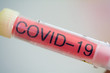Corona, Covid-19, Test, Corona Test, Abstrich, Viren, Virus,