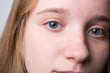 © Eugene - Teen girl portrait. Cute young girl. Redhead girl with freckles.