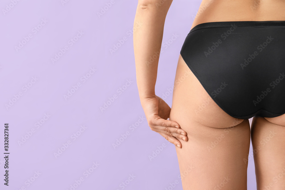 Young woman with cellulite problem on color background
