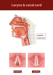 medical illustration for explain diseases