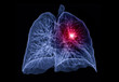 CT lung 3d rendering imag