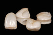 Zahnkronen und  Veneer aus Vollkeramik