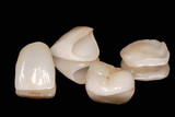 Fototapeta Konie - Zahnkronen und  Veneer aus Vollkeramik