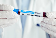 Male Doctor With Positive Blood Sample For Coronavirus Disease, Covid-19