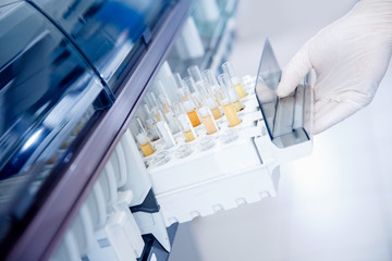 Wall Mural - express analysis of human urine in medical laboratory. lab technician holds test tube setup