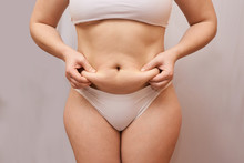 Fat Unhealthy Woman Body. Pinch Belly Side. Measurement Lady Procedure. Medicine Pinching. Anti Cellulite Overweight.