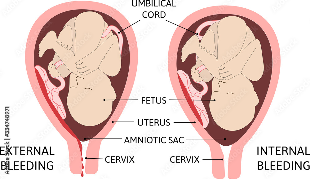 child vagina 