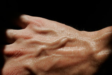 Dorsal Of A Sweaty Hand With Many Veins On A Black Background