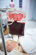 Closeup view of blood transfusion in intensive care unit.