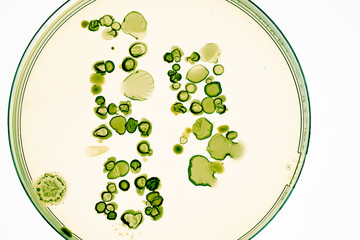 Poster - Mixed of bacteria colonies and fungus in various petri dish