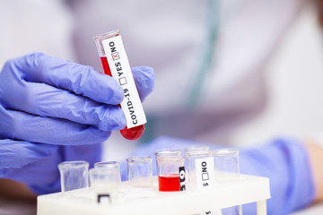 Woman at the hospital submits a blood test for a coronavirus