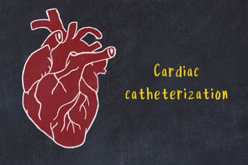 Wall Mural - Chalk sketch of human heart on black desc and inscription Cardiac catheterization