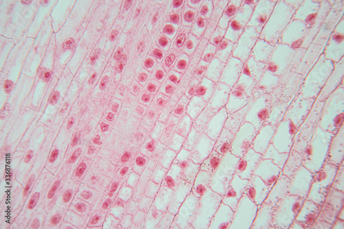 Root tip of Onion and Mitosis cell in the Root tip of Onion under a microscope Poster Mural XXL