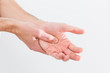 © Angelov - Man with painful and inflamed gout on his hand around the thumb area.