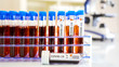 Three test tube kits marked positive for coronavirus