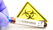 The yellow hazard sign with the COVID-19 coronavirus positive kit