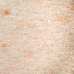 Soft focus human skin texture with black hairs for healthy textu