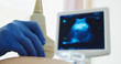 Close up of a pregnant woman having ultrasound scanning at the medical clinic. Ultrasound monitor in the background. Family planning concept