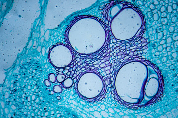 microscopic image of pumpkin stem (cross-section)