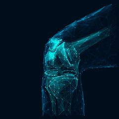 Aufkleber - Human knee low poly wireframe vector illustration. Polygonal body part isolated on dark blue background. Bone joint 3d mesh art with connected dots. Futuristic medicine, orthopedic treatment concept