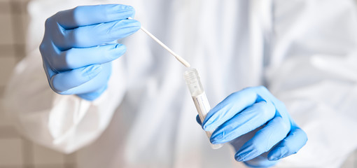 doctor holding swab test tube for 2019-ncov analyzing. coronavirus test. blue medical gloves and pro